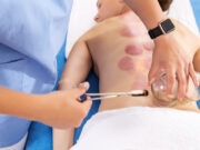 Bankovanie. Stredoveká metóda, ktorá masíruje a lieči zároveň