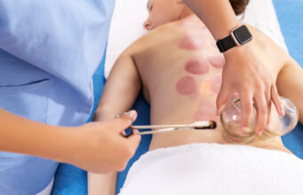 Bankovanie. Stredoveká metóda, ktorá masíruje a lieči zároveň