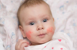 Najčastejšie zdravotné problémy malých detí v prvom roku života
